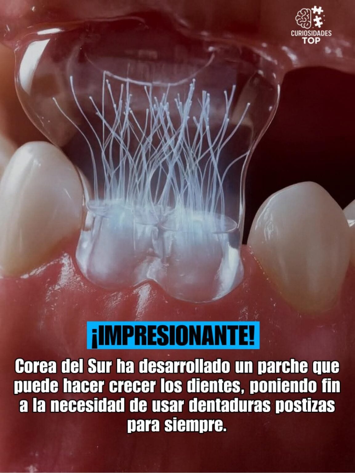 Parche bioactivo podría regenerar dientes